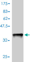 WB - S100A4 Antibody (monoclonal) (M01) AT3757a